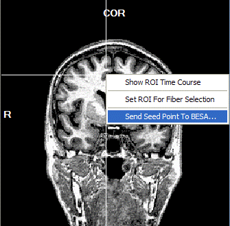 MRI Integration (12).gif