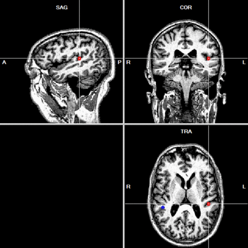 MRI Integration (11).gif