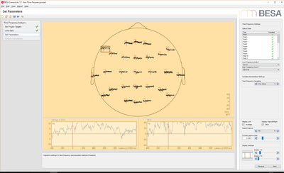 BESA Connectivity Set Parameters EEG Data.png