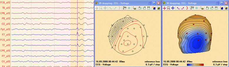 File:Mapping (1).gif