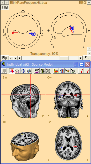 Integration with MRI and fMRI - BESA® Wiki