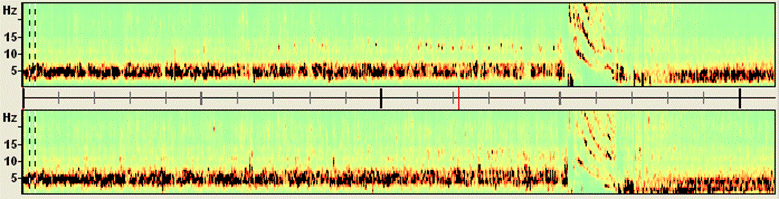 BESA Research Spectral Analysis - BESA® Wiki